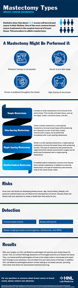 mastectomy-infographic