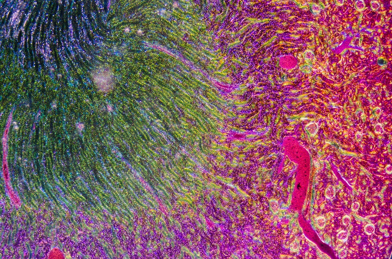 Kidney-Tissue-under-microscope_small